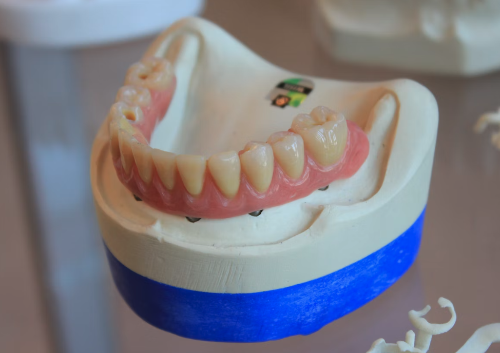 tooth model